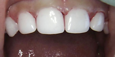 Image for 