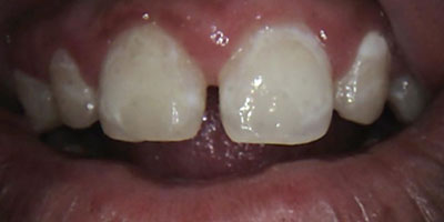 Image for 