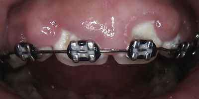 Image for 