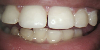 Image for 