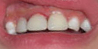 Image for 
