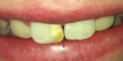 Image for 